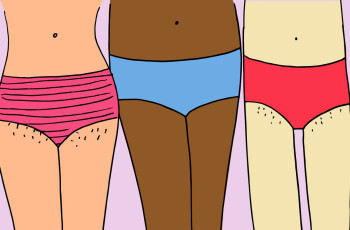 Раздражение в области бикини: причины и уход за кожей