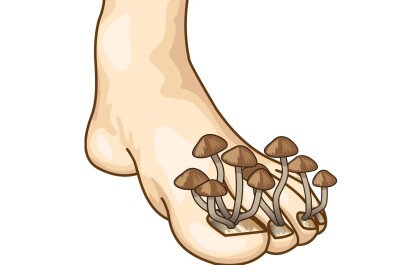 Практические советы как справиться с грибком ногтях на ноге