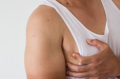 Почему у мужчин бывает большая грудь – причины гинекомастии
