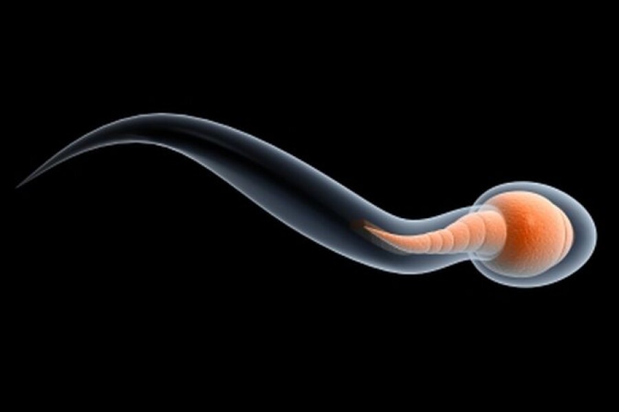 строение сперматозоида