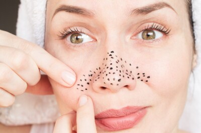 Как очистить кожу лица и избавиться от прыщей