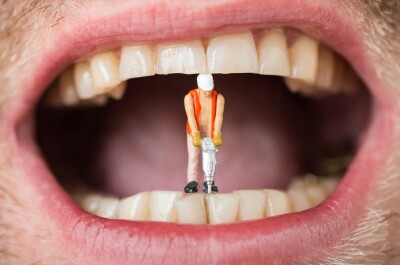 Эффективные способы избавления от зубного камня