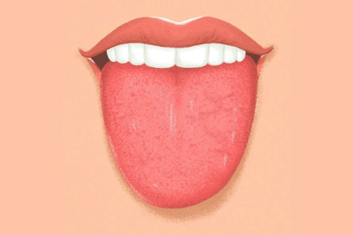 Синехии половых губ у девочек